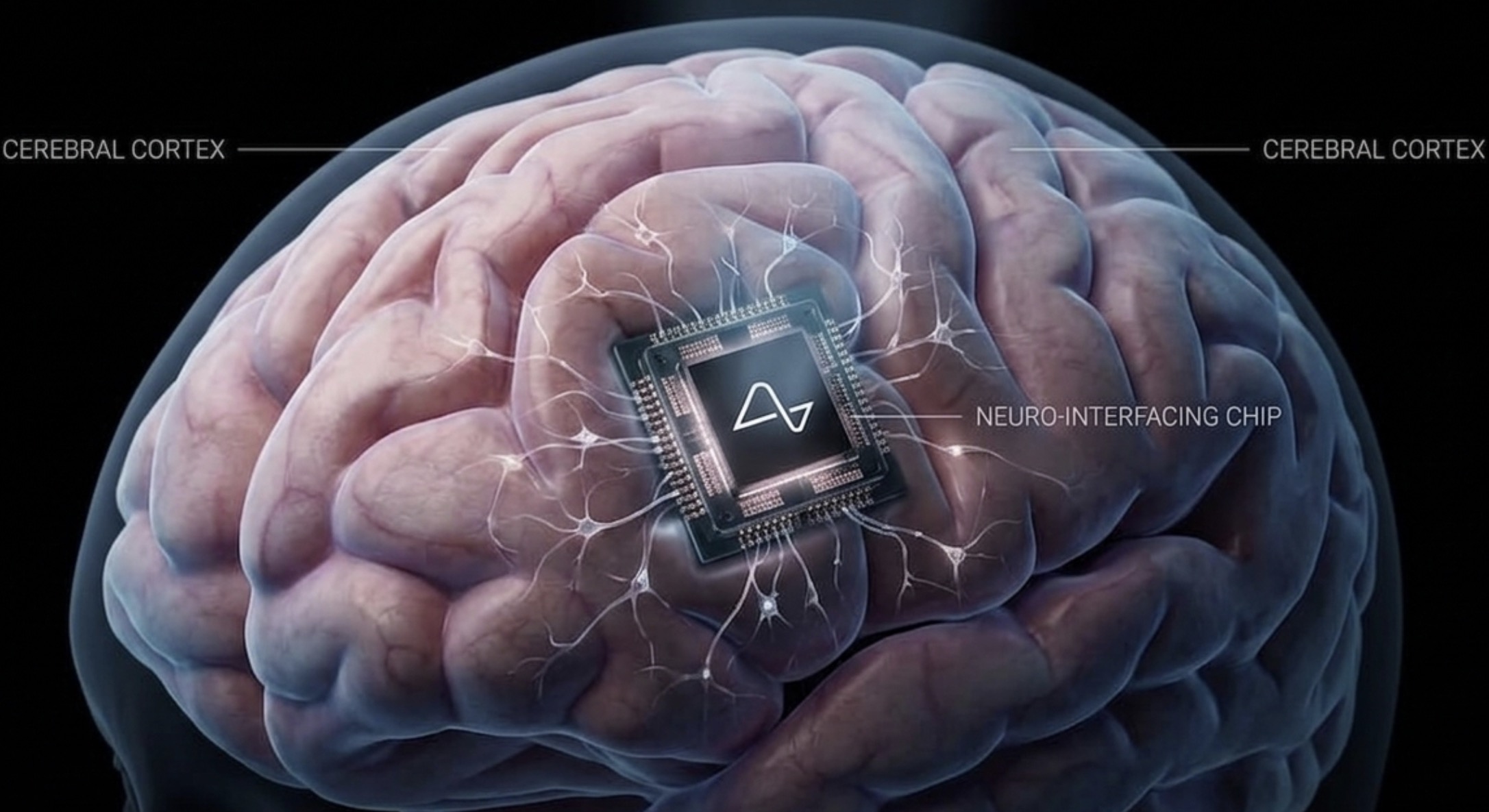 Neuralink
